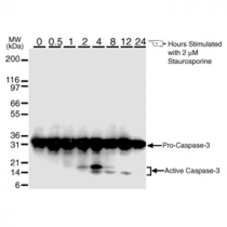 Caspase 1 Activation Caspase 3