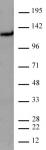 CtIP antibody mpAb) tested by Western blot