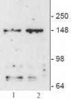 JMJD3 / KDM6B antibody (mAb) tested by Western blot.