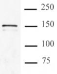 Cas9 antibody (mAb) tested by immunoprecipitation.