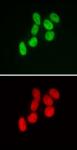 SMARCB1 antibody (mAb) tested by immunofluorescence.