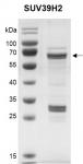 Recombinant SUV39H2 protein.