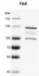 Recombinant FAK protein gel