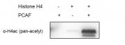 Western blot for recombinant PCAF activity