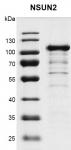 Recombinant NSUN2 protein
