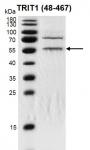 ecombinant TRIT (48-467) protein gel