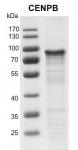 Recombinant CENPB proteingel