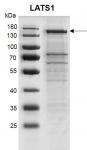 Recombinant LATS1 protein gel
