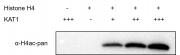 Western blot for Recombinant KAT1 / HAT1 protein activity