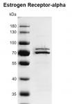 Recombinant Estrogen Receptor-alpha protein gel