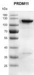 Recombinant PRDM11 protein gel