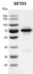 Recombinant SETD3 protein gel
