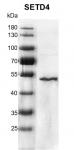 Recombinant SETD4 protein
