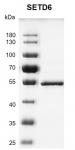 Recombinant SETD6 protein gel