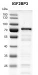 Recombinant IGF2BP3 protein gel