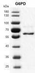 >Recombinant G6PD protein gel