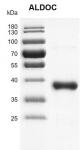 Recombinant ALDOC protein gel