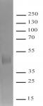 Recombinant SARS-CoV-2 Spike protein, S1 (aa319-589) protein gel.