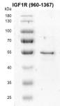 Recombinant IGF1R (960-1367) protein