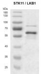 Recombinant STK11 / LKB1 protein
