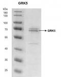 Recombinant GRK5 protein