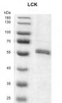 >Recombinant LCK protein