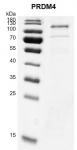 Recombinant PRDM4 protein