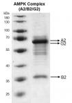 Recombinant AMPK Complex (A2+B2+G2) protein