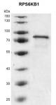 Recombinant RPS6KB1 protein