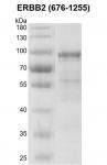 Recombinant ERBB2 (676-1255) protein