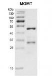 Recombinant MGMT protein