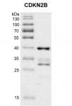 Recombinant CDKN2B protein