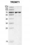 Recombinant TRDMT1 protein