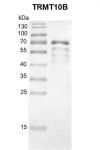 Recombinant TRMT10B protein