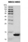 Recombinant MBD2-MBD Coomassie gel