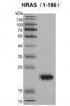 HRAS Coomassie gel