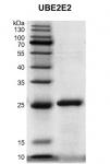 Recombinant UBE2E2 protein gel.