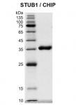 Recombinant STUB1 / CHIP protein Coomassie gel