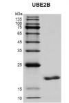 Recombinant UBE2B protein gel.