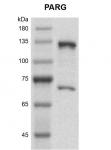 Recombinant PARG protein gel.