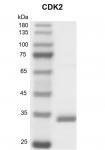 Recombinant CDK2 protein gel