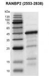Recombinant RANBP2 (2553-2838) protein gel