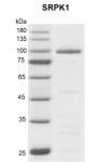Recombinant SRPK1 protein gel