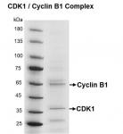 Recombinant CDK1/Cyclin B1 protein gel