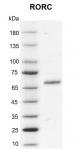 Recombinant RORC protein gel