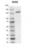 Recombinant DHX9 protein gel