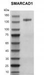 Recombinant SMARCAD1 protein gel