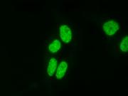 AbFlex<sup>&reg;</sup> Histone H4K20me3 antibody (rAb) tested by immunofluorescence.