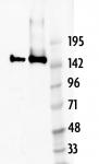 AbFlex<sup>&reg;</sup> Cas9 antibody (rAb) tested by Western blot.