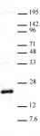 AbFlex<sup>&reg;</sup> Histone H3K27me3 antibody (rAb) tested by Western blot.
